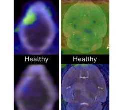 ALS drug repurposed for PET imaging