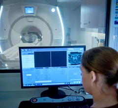 GE HealthCare MRI magnetic resonance imaging