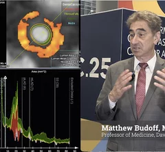 Dan Budoff explains use of CCTA to track coronary disease plaque progression