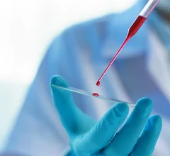 blood test research laboratory