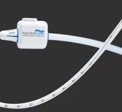 The PleuraFlow Active Clearance Technology (ACT) System from ClearFlow 