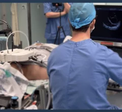 ROB’E Robotic transesophageal echocardiography (TEE)