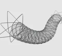 Roadsaver Carotid Stent System