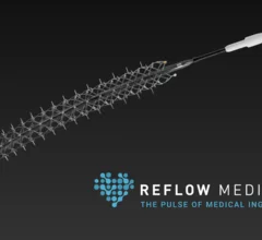 Reflow Medical Spur Peripheral Retrievable Stent System