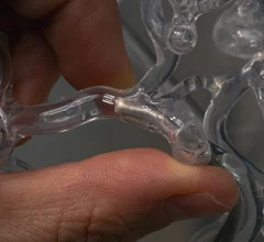 milli-spinner thrombectomy designed to target blood clots by engineers with Stanford University 