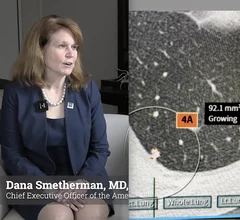 Dana Smetherman, MD, MPH, MBA, FACR, chief executive officer of the American College of Radiology, explains an American Medical Association (AMA) resolution ACR is supporting to expand low-dose CT lung cancer screenings and coronary calcium scoring. 