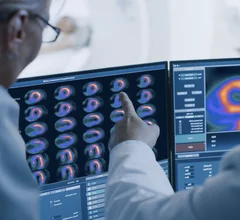 Imagers reviewing flurpiridaz F-18 (Flyrcado) myocardial perfusion PET images. Image from GE Healthcare