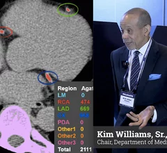 Former American College of Cardiology (ACC) president Kim Allan Williams, Sr., MD, MACC, MASNC, FAHA, FESC, chair, department of medicine, University of Louisville School of Medicine, and an ACC delegate to the American Medical Association House of Delegates, discusses AMA Resolution 404 aimed at improving public awareness of low-dose CT lung cancer screening that can also identify coronary artery disease (CAD) ate the same time. 