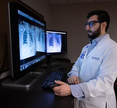 radiologist x-ray artificial intelligence x-ray Samir F. Abboud
