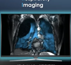 FDA approves expanded use of Xenoview for lung imaging