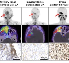 2025 SNMMI Image of the Year