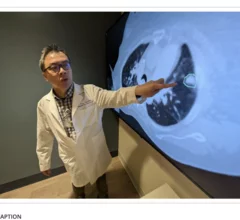 Troy Teo explains iSeg AI tool for lung tumor segmentation.