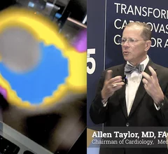 Video interview with Allen Taylor, MD, chairman of cardiology at Medstar, who explains use of AI CCTA plaque analysis at Medstar to improve risk assessments.