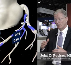 Cardiac surgeon John Puskas, MD, Emory University, says CCTA will make invasive angiography obsolete very soon.