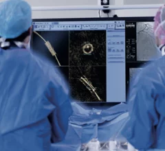 ge_healthcare_3dstent_.png
