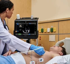 GE Healthcare's Venue Go point-of-care ultrasound (POCUS) system features AI-enabled tools to speed workflows, including Caption Guidance to help non-expert users capture diagnostic quality cardiac images. These systems helped drive positive earnings for the company in Q2 2025. 