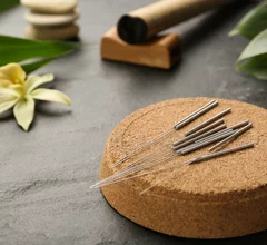 Acupuncture improves brain structure in TBI patients