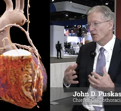 John D. Puskas, MD, MSc, PhD., FACS, FACC, professor of surgery, and chief of cardiothoracic surgery at Emory University Hospital Midtown, explains when patients are best served with coronary artery bypass graft (CABG) surgery rather than percutaneous coronary intervention (PCI).