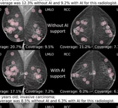 Eye-tracking reveals radiologists' reading habits when under the influence of AI