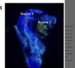 Bacteria-based contrast agent lights up tumor margins significantly better than other agents.