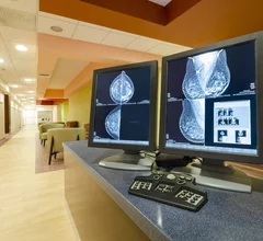 mammography breast imaging