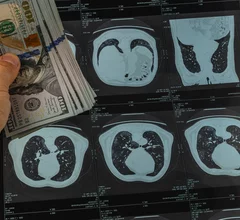 imaging radiology money scans compensation pay dollar