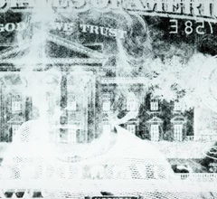 Radiology x-ray money scan dollar