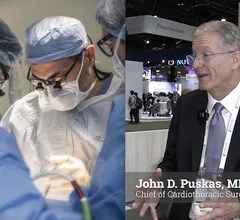 John Puskas, MD, MSc, PhD., FACS, FACC, professor of surgery, and chief of cardiothoracic surgery at Emory University Hospital Midtown, explains how interventional cardiologists can play a role in increasing referrals for coronary artery bypass graft (CABG) surgery for patients who are best suited for the procedure, as opposed to percutaneous coronary intervention (PCI). As the heart team approach expands across cardiology, with surgeons and interventionalists making more decisions together.