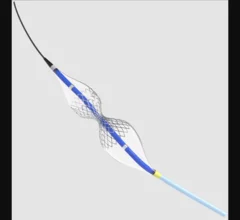 coronary sinus reducer shockwave medical