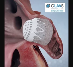 Conformal Medical CLAAS