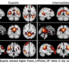 Prompt engineering experts' brains are wired differently