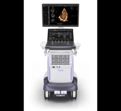 GE HealthCare Vivid Pioneer cardiovascular ultrasound