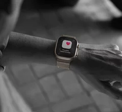 The new Apple Watch Ultra 3 offers a groundbreaking hypertension notifications alert users if signs of hypertension are detected using data from its optical heart sensor to analyze how a user’s blood vessels respond to heart beats. The algorithm works passively in the background, reviewing data over 30-day periods, and will notify users if it detects consistent signs of hypertension. 