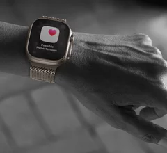 The U.S. Food and Drug Administration (FDA) cleared a smart watch artificial intelligence (AI) algorithm that tells wearers if they are suspected of having hypertension, which is expected to help notify about 1 million users over the next year. This a is a new feature of the newly launched Apple Watch Ultra 3, which the company unveiled Sept. 9. Apple gained FDA for its Cardiovascular Machine Learning-Based Notification Software Hypertension Notification Feature (HTNF) Sept. 11, 2025.