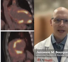 American Society of Nuclear Cardiology (ASNC) President-elect Jamieson M. Bourque, MD, MHS, FASNC, medical director of nuclear cardiology, echocardiography, and the stress laboratory at UVA Health in Charlottesville, and a professor of medicine and radiology at the University of Virginia, explains key trends and his plans to advance nuclear cardiology in 2026. #ASNC