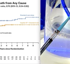 The key figure from NEJM publication confirms the survival benefit of Impella CP increases year-over-year. Source: Møller J, et al. Long Term Outcomes of the DanGer Shock Trial. N Engl J Med 2025.