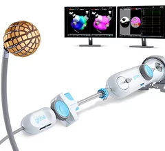 The U.S. Food and Drug Administration (FDA) has granted pre-market approval (PMA) for the Globe Pulsed Field Ablation (PFA) System, and 510(k) clearance for both the Globe introducer sheath and the Globe Pulsed Field System mapping software from Kardium Inc. This add another competitor in the growing U.S. PFA market to treat atrial fibrillation (AFib).
