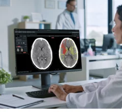 Brainomix 360 triples number of stroke patients who regain functional independence.