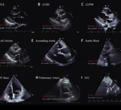 Cardiologists have developed an open-source artificial intelligence (AI) model capable of accurately evaluating a long list of measurements on echocardiography results. The group detailed the development and validation of that model in the Journal of the American College of Cardiology.