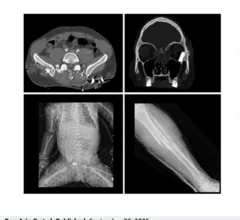 Radiology providers from Israel share how their hospital handled the mass casualties caused by the October 2023 terror attacks.