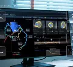 Heartflow PCI Navigator Cardiology