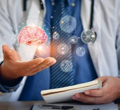 brain stethoscope alzheimer's dementia