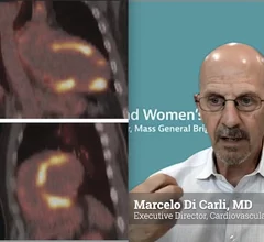 Nuclear cardiology is entering a new era—one that goes well beyond the traditional focus on myocardial perfusion imaging. According to Marcelo Di Carli, MD, editor-in-chief of the Journal of Nuclear Cardiology and chief of the Division of Nuclear Medicine at Brigham and Women’s Hospital, the field is rapidly expanding into diagnosing and monitoring complex cardiac diseases such as amyloidosis, sarcoidosis, myocarditis, and cardiac infections.