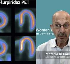Marcelo Di Carli, MD, editor-in-Chief of the Journal of Nuclear Cardiology, chief, Division of Nuclear Medicine and Molecular Imaging, Department of Radiology, and executive director, Cardiovascular Imaging Program, at Brigham and Women's Hospital, explains why there is rapid growth of PET imaging because of the extra value it brings in detecting microvascular disease. 