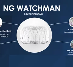The next generation Watchman device is designed to better seal off complex LAA anatomy to prevent strokes in atrial fibrillation patients. It uses an optimized architecture to fill gaps and adapt to the unique characteristics of each patient's appendage, which come in a wide variety of shapes and sizes.