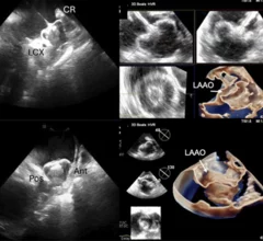 SCAI ICE position statement