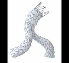 Endurant stent graft system labeling
