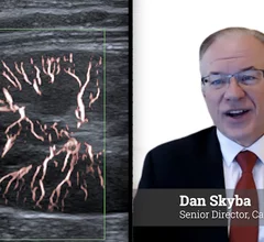 Caon Medical USA ultrasound director Dan Skyba explains advances in ultrasound processing algorithms at RSNA 2025.