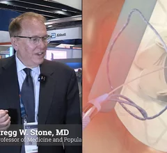 Gregg W. Stone, MD, Director of Academic Affairs for the Mount Sinai Health System and Professor of Medicine (Cardiology) and Professor of Population Health Science and Policy at the Icahn School of Medicine at Mount Sinai, discusses the ATHENS-HF Trial, a first-in-man study of a chronically-adjustbable, bi-atrial pressure sensing inter-atrial shunt from Adona Medical.