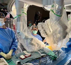 robotic aortic valve replacement (RAVR)